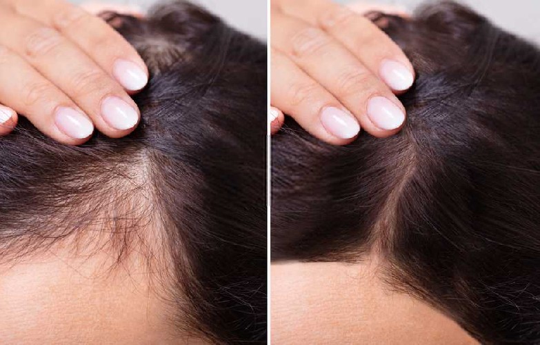 metodi naturali per far allungare i capelli