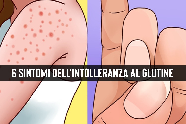 https://www.ragusanews.com/immagini_articoli/02-03-2022/intolleranza-al-glutine-quali-sono-i-sintomi-inconfondibili-piu-comuni-500.jpg