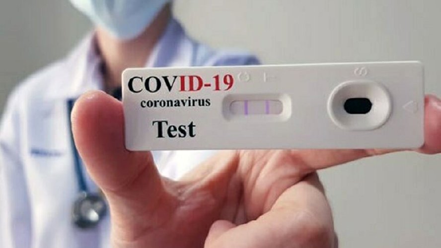 https://www.ragusanews.com/immagini_articoli/23-11-2020/tampone-rapido-nelle-farmacie-di-roma-quanto-costa-come-e-dove-farlo-500.jpg