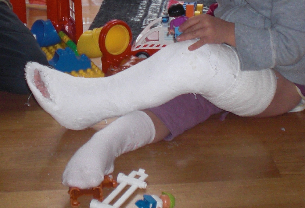 Bambino cade dal tetto per recuperare il pallone, si frattura gamba