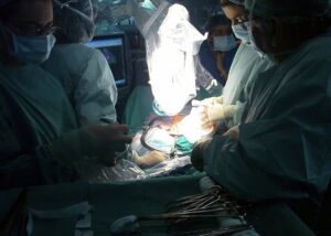 Operazione al colon