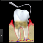 App per dentisti