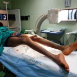 migrante malformazione