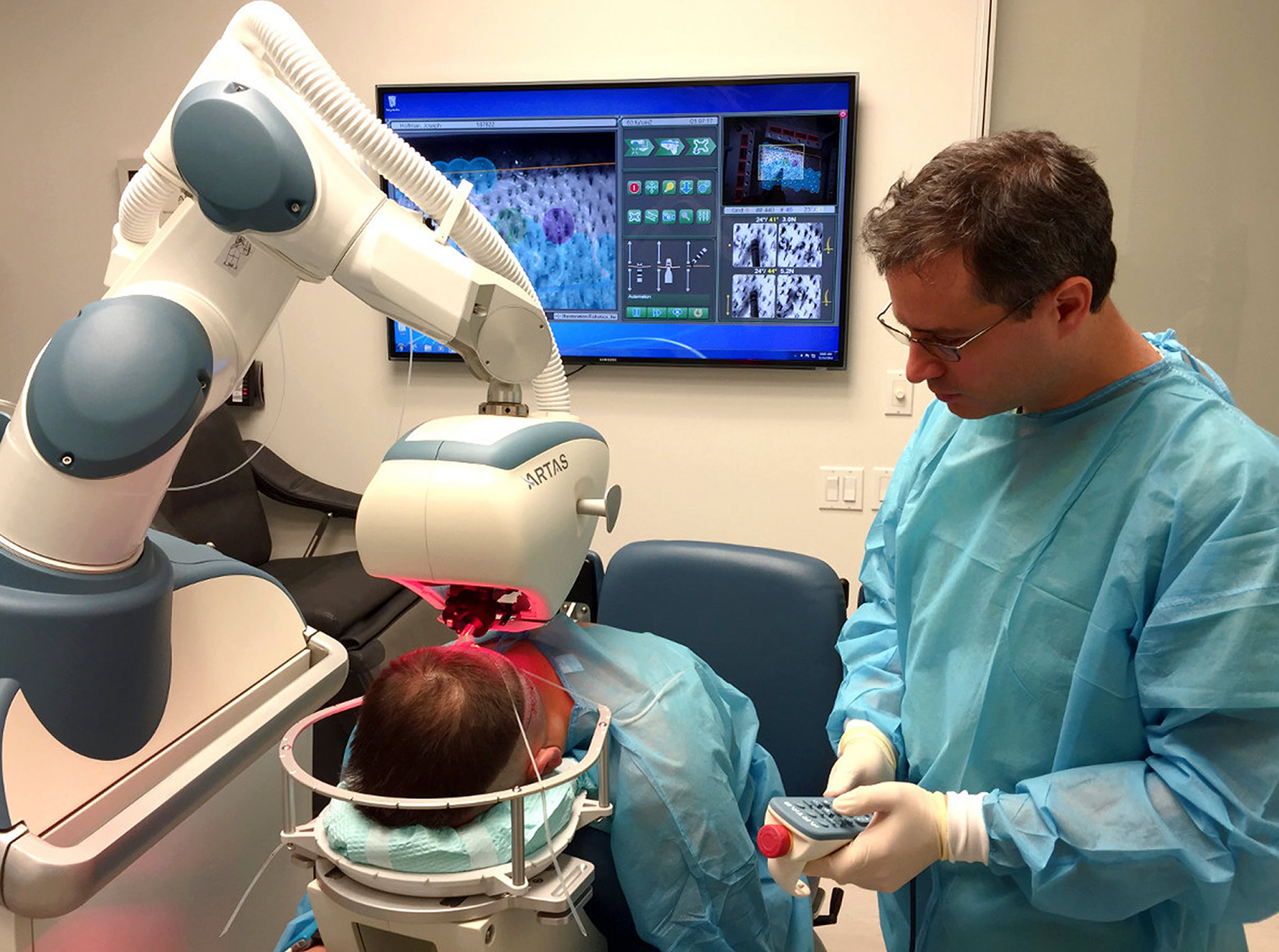 Calvizie, un robot trapianterà i vostri capelli