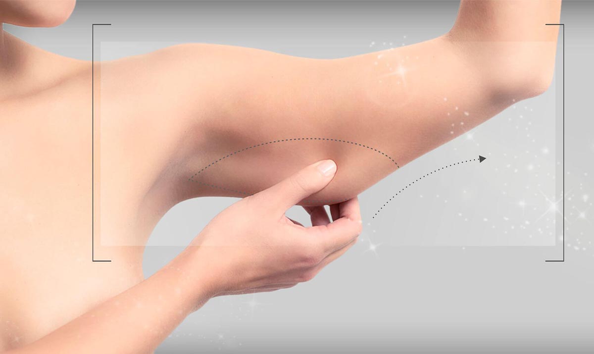 Liposuzione? No. C’è la laserliposi. Alternativa alla dieta