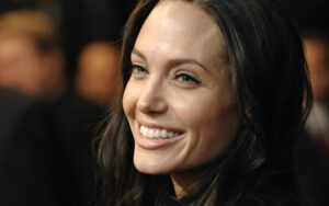 Denti bianchi e sorriso smagliante