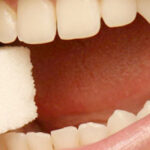 Diabete, i danni a denti e gengive