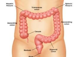 Tumore al colon