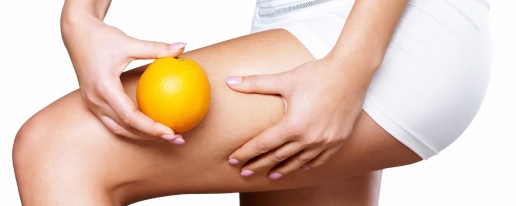 Cellulite o pelle a buccia d'arancia