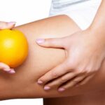Cellulite o pelle a buccia d'arancia