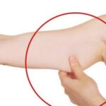 Dimagrire le braccia