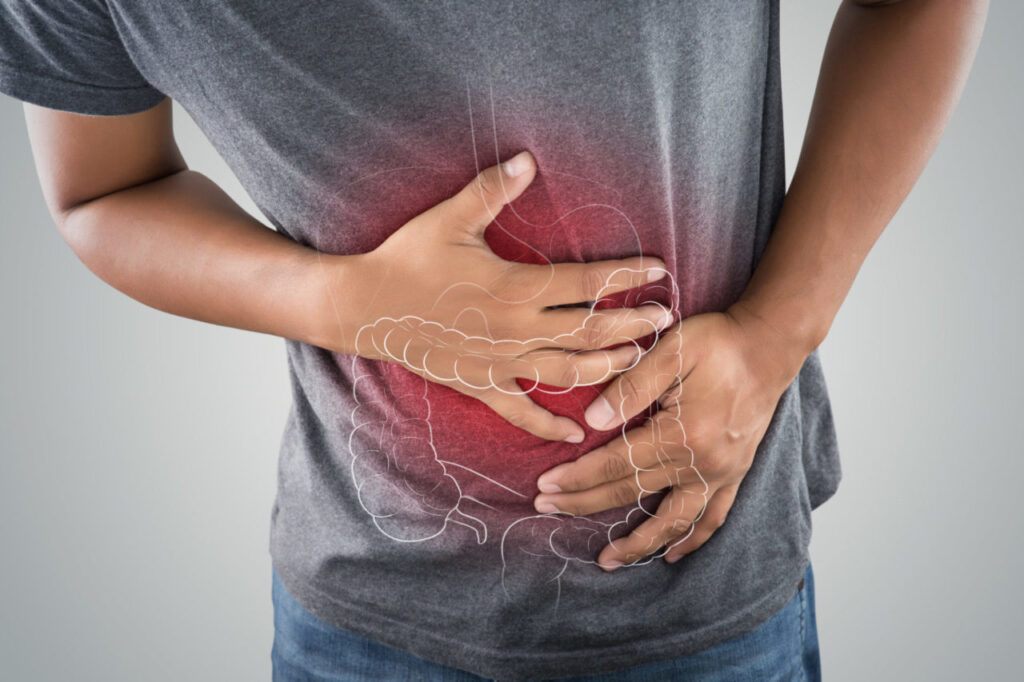 Dieta e sindrome del colon irritabile