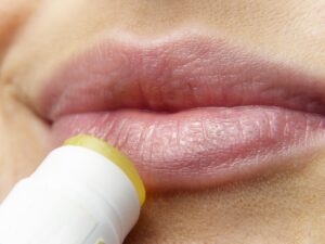 Dieta in caso di herpes