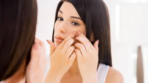 La dieta anti acne