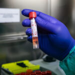 Virus, primo morto in Sicilia