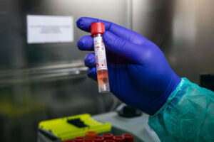 Virus, primo morto in Sicilia