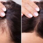 Come accelerare la crescita dei capelli con la ricetta fai da te