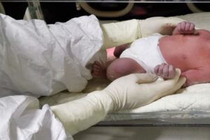Taormina, mamma covid riabbracciala figlia dopo intervento al cuore