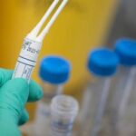 Coronavirus: tutti negativi i 63 tamponi eseguiti a Panarea