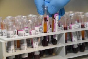 Coronavirus: ufficio statistica, Sicilia ultima per tamponi