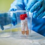 Primo caso confermato di reinfezione