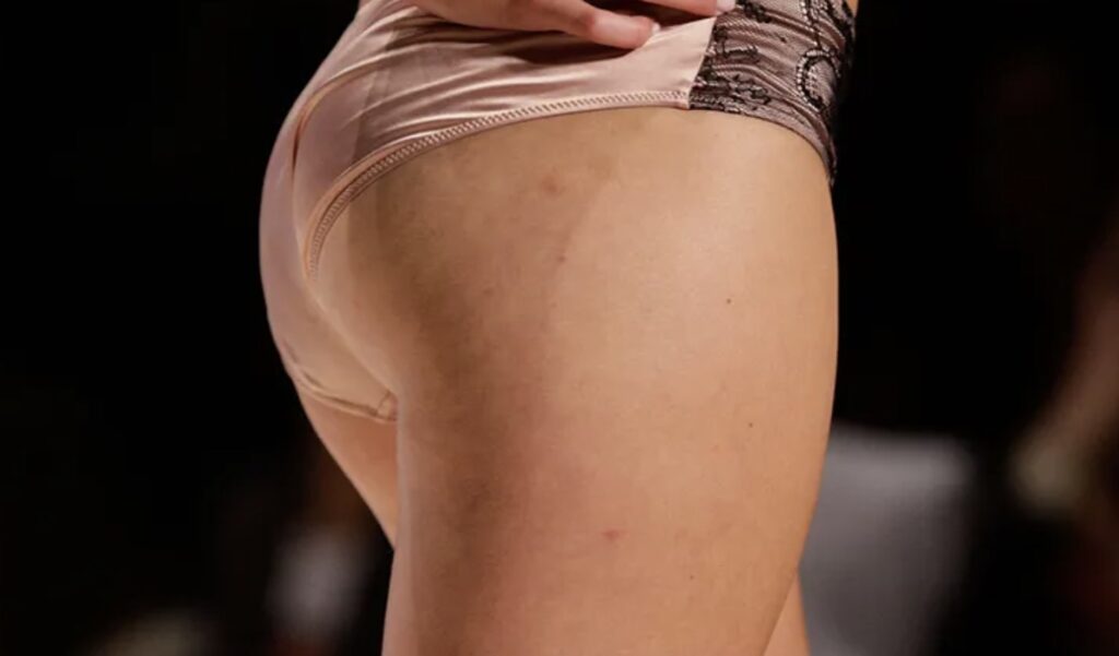 La dieta anticellulite