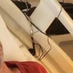 Nek ricoverato d'urgenza in ospedale vittima di un incidente domestico