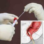 Tamponi “alternativi” anti Covid: l’ultima frontiera dei test infettivi