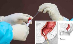Tamponi “alternativi” anti Covid: l’ultima frontiera dei test infettivi