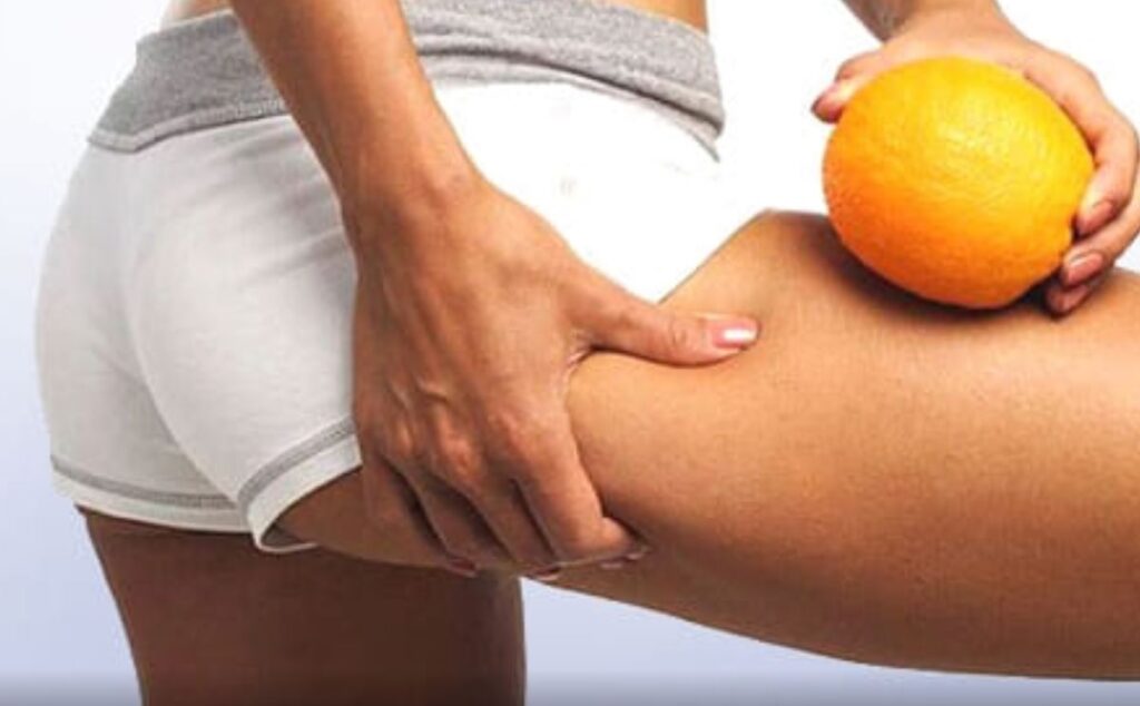 Eliminare la cellulite? E' possibile, con una dieta sana