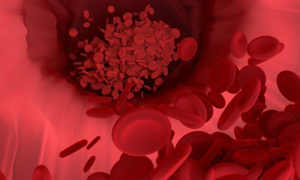 Astrazeneca, scoperta la causa delle trombosi