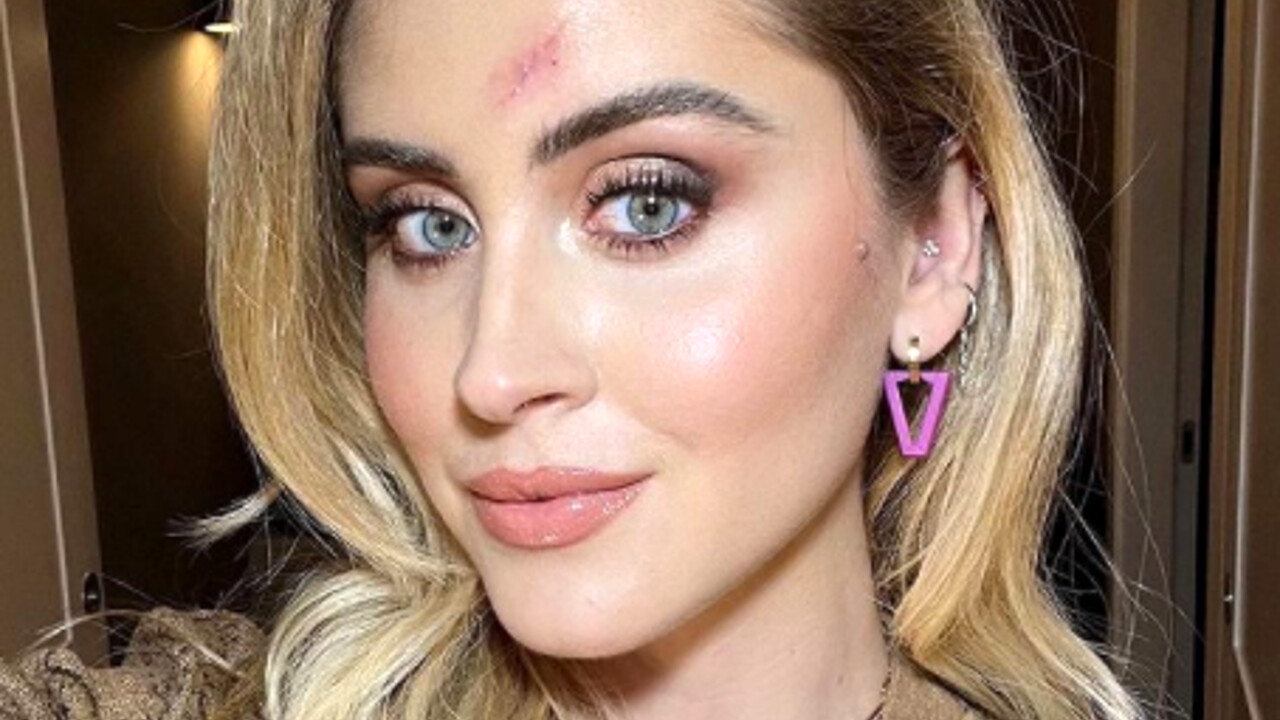 Valentina Ferragni a Verissimo parla del suo tumore alla pelle