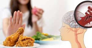 Dieta: cosa mangiare per ridurre il rischio di ictus?