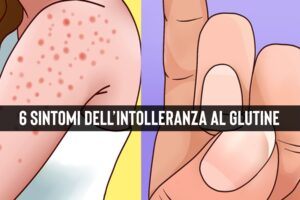 Intolleranza al glutine: quali sono i sintomi inconfondibili?