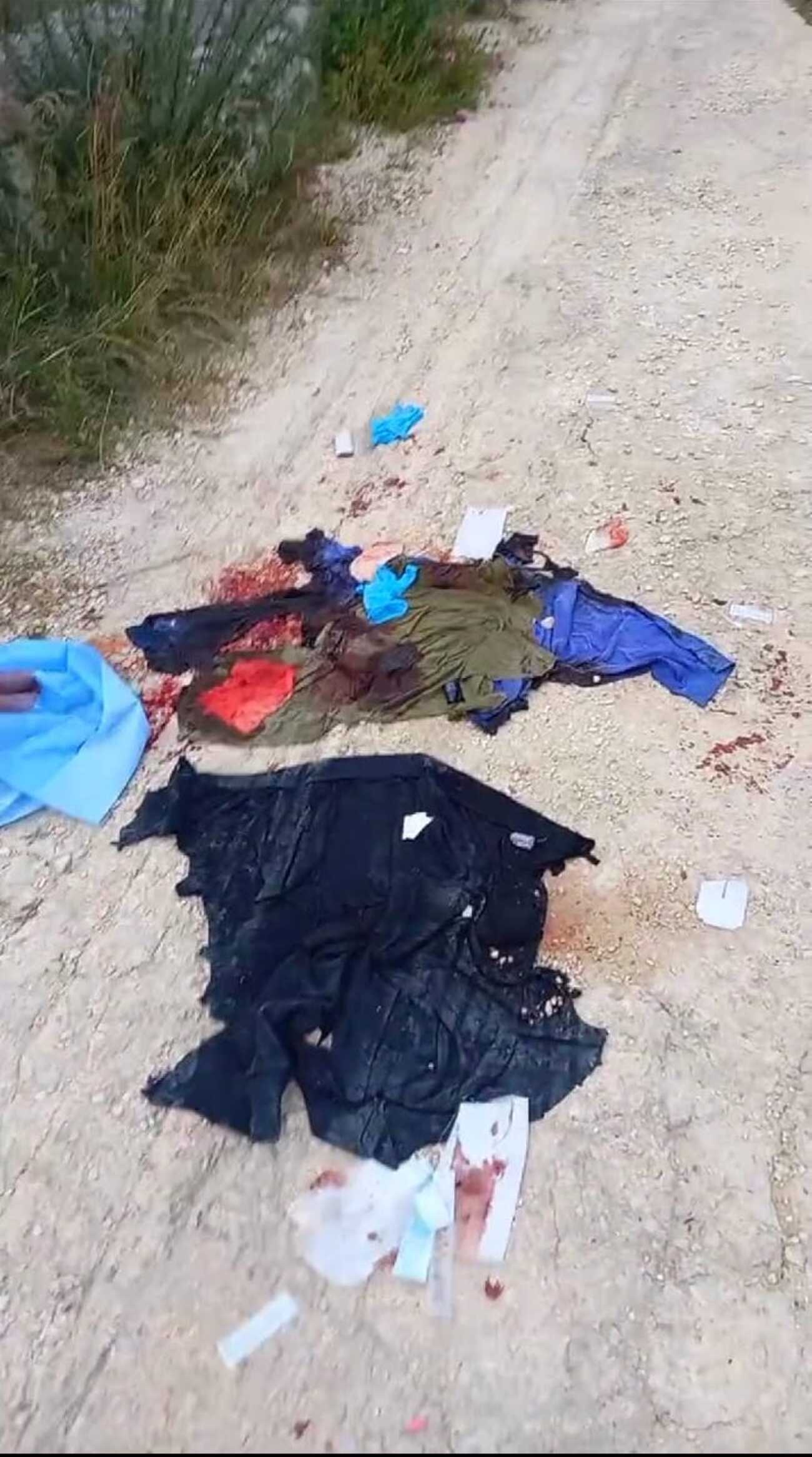 Scoppio di Ispica, trasferito il ragazzino cui è stato ricostruito il volto