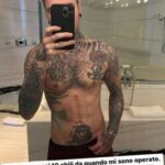 Fedez mostra il fisico allo specchio: "Persi 10 chili dopo l'operazione"