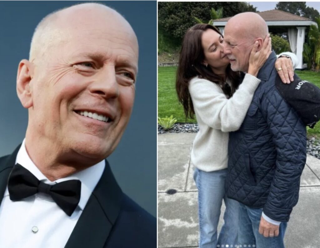 Bruce Willis &laquo;ha perso la gioia di vivere e ha ridotte capacit&agrave; linguistich