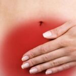 Morbo di Chron, una dieta può portare alla remissione