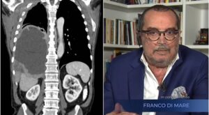 Franco Di Mare, la malattia: "La Rai mi ha abbandonato"