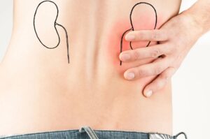 Proteggere i reni, ecco la dieta da seguire