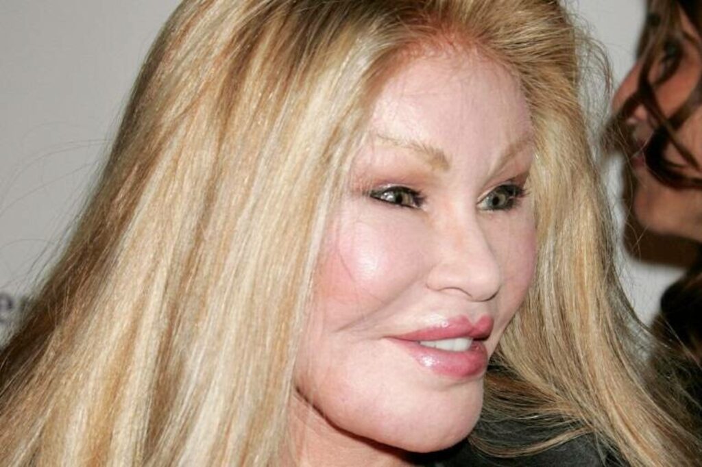 Addio alla "donna gatto": l'icona del jet set Jocelyne Wildenstein aveva 84 anni