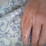 Ho un infortunio in itinere mentre vado a lavoro