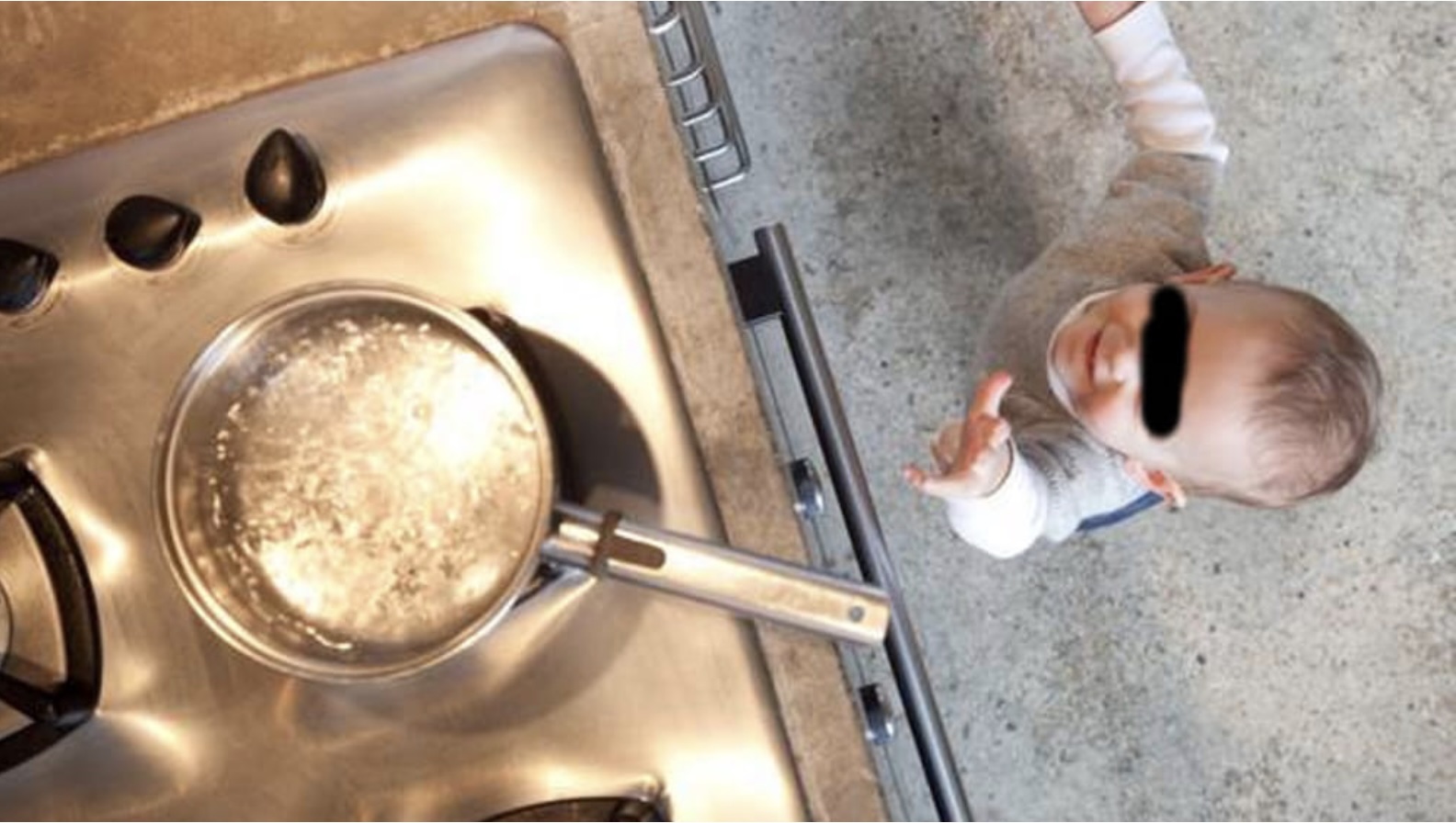 Bambino di 18 mesi si ustiona buttandosi acqua bollente addosso