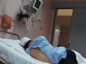 Critiche ma stabili le condizioni dell'11enne caduto dal secondo piano a Pozzallo