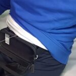 Pompa sottocutanea contro il Parkinson: prima volta in provincia di Ragusa, la paziente migliora