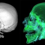 Pubblicato su rivista internazionale lo studio scientifico sulle mummie di Sant’Anna a Modica