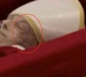 Papa Francesco, cosa è quella macchia sul volto