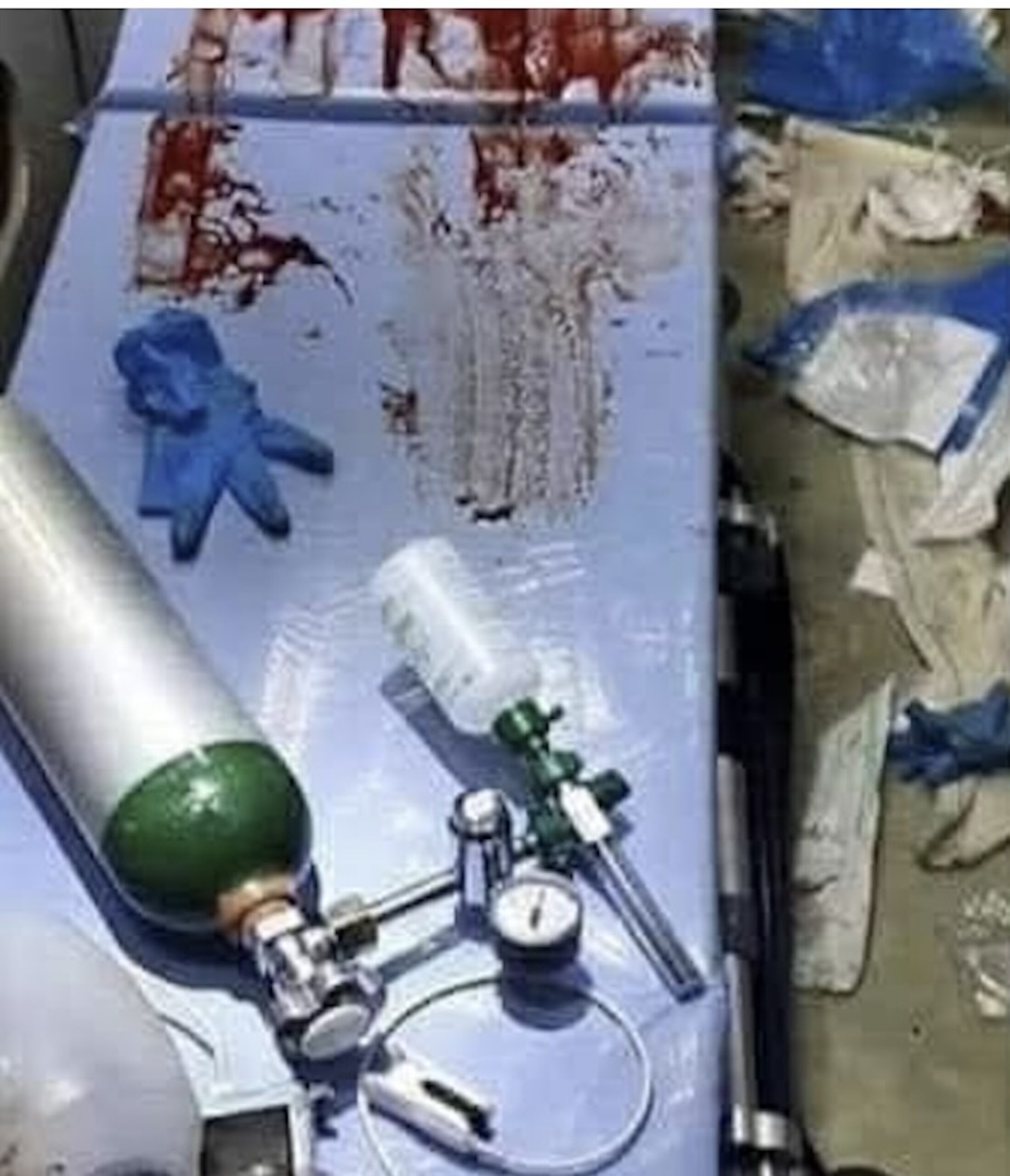 Scoglitti, accoltellamento davanti a una farmacia nel corso della notte